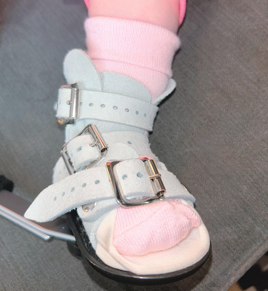 Talipes (Clubfoot) Boots &amp; Bar Socks – The Little Sock Company