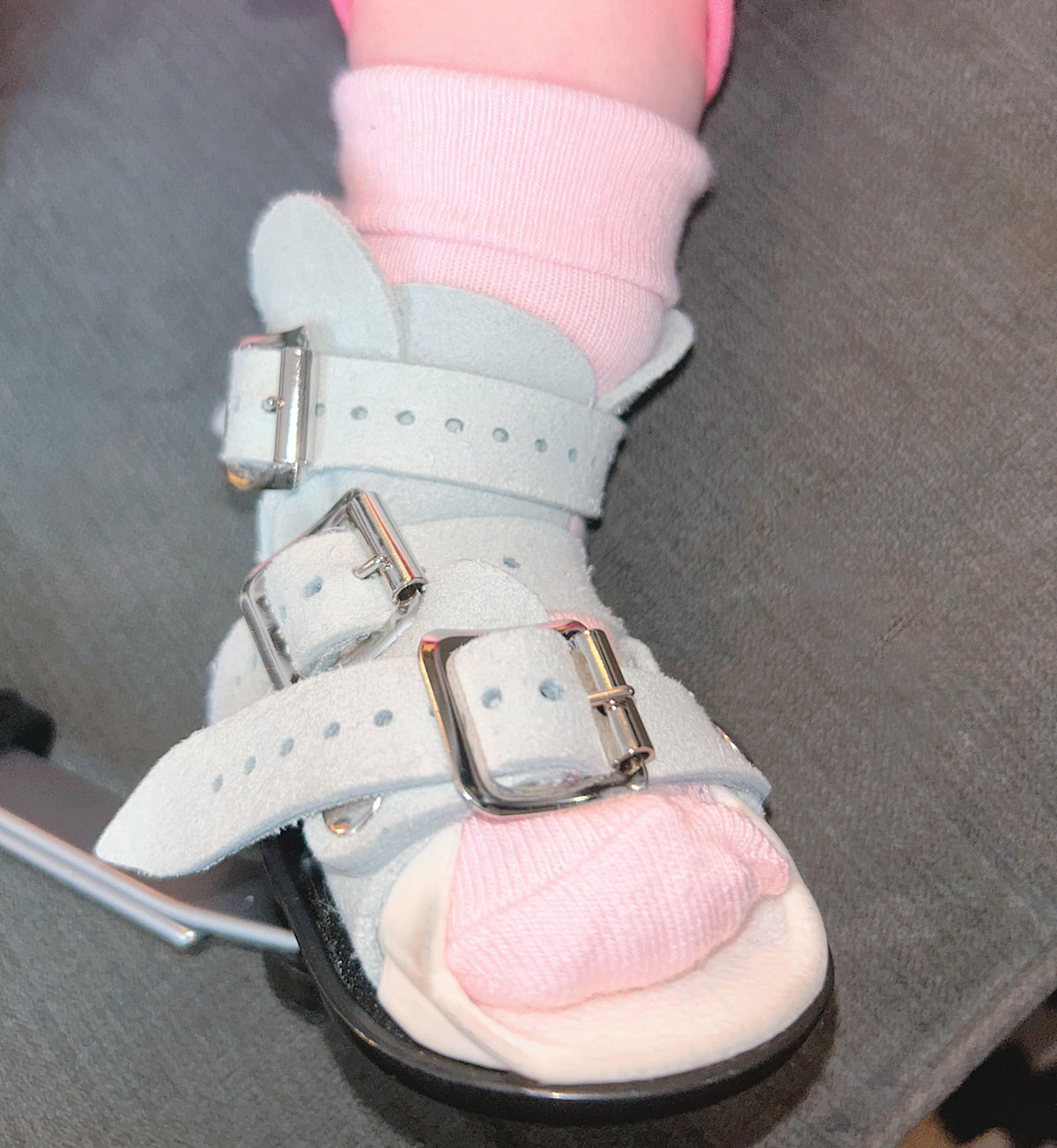 Talipes (clubfoot) Boots and Bar Socks - Non-Slip Stay On Baby and Toddler Socks - 5 Pack in Pink & Blush Stripe